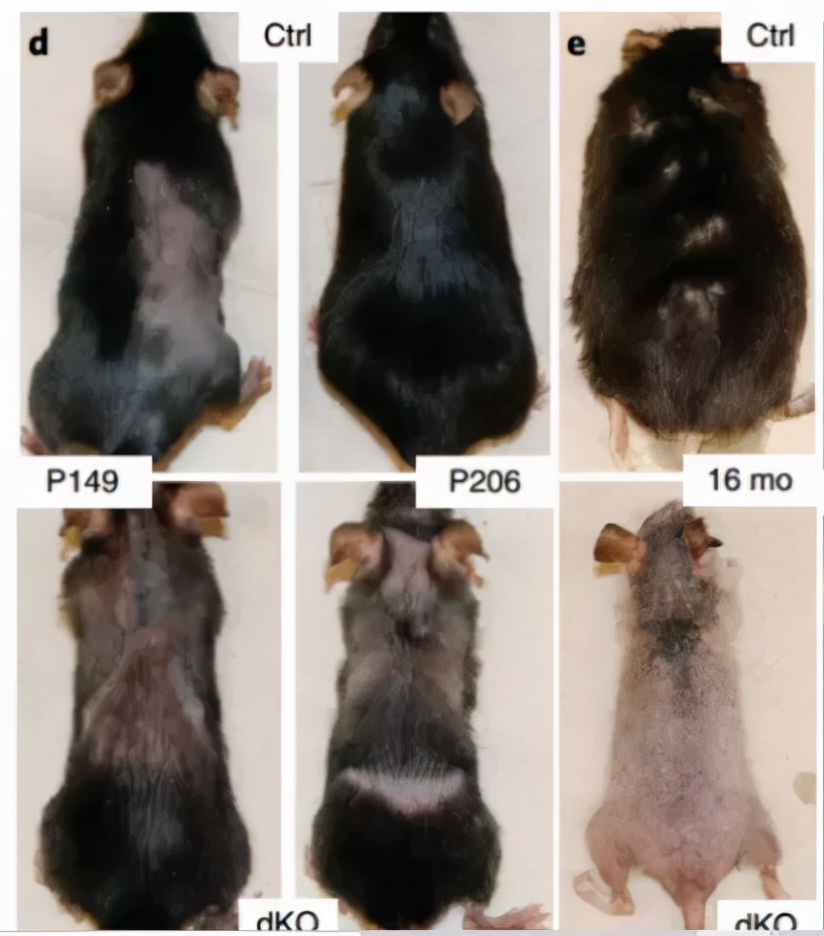 秃头是因为毛囊坏死吗,毛囊干细胞治疗秃头