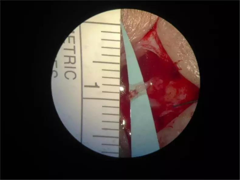 显微手术机器人,新型手术机器人