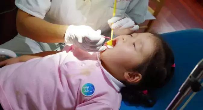 预防儿童蛀牙可打针预防吗,预防蛀牙可做窝沟封闭