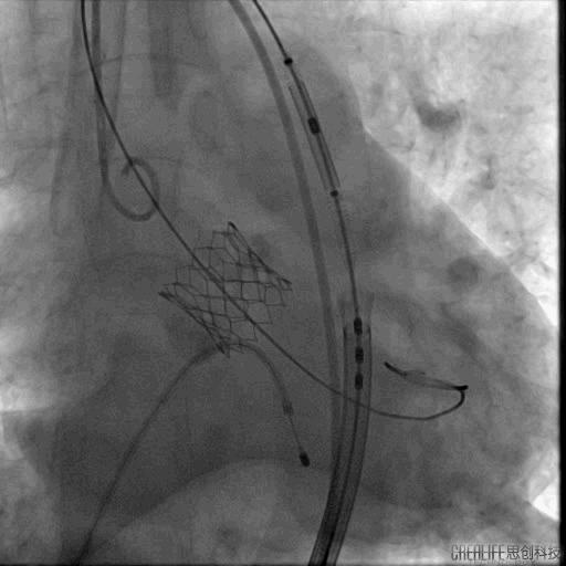 罗建方医生怎么样,罗建方教授