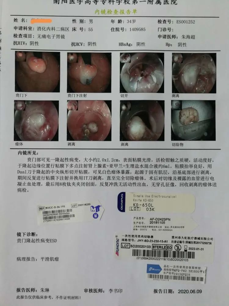 贲门处见隆起性病变,贲门高级别瘤变esd术后不能吃什么