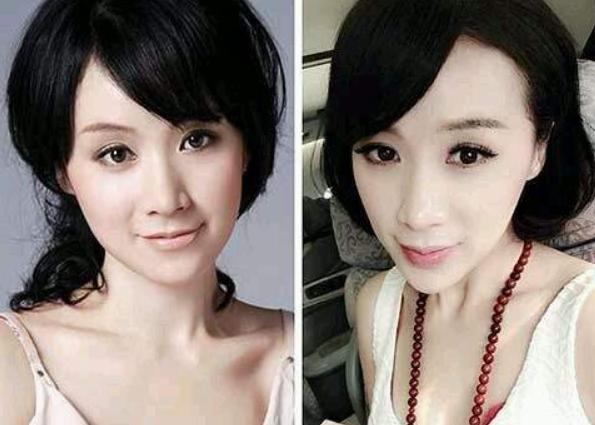 霸屏女主变蛇精，姚芊羽从“万人捧”到“万人踩”，只因矫过牙？