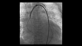 92岁老人心肺衰竭还能活多久,92岁爷爷肺不好