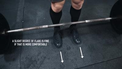 硬拉容易练到腰怎么办,硬拉时受的伤能好么