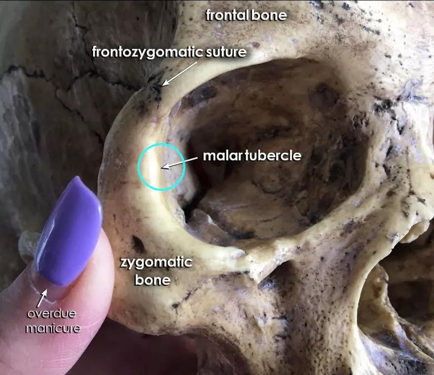 法医根据头骨还原死者,颅骨还原画像原理