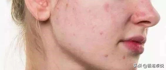 口罩神器医护专用口罩,口罩救星