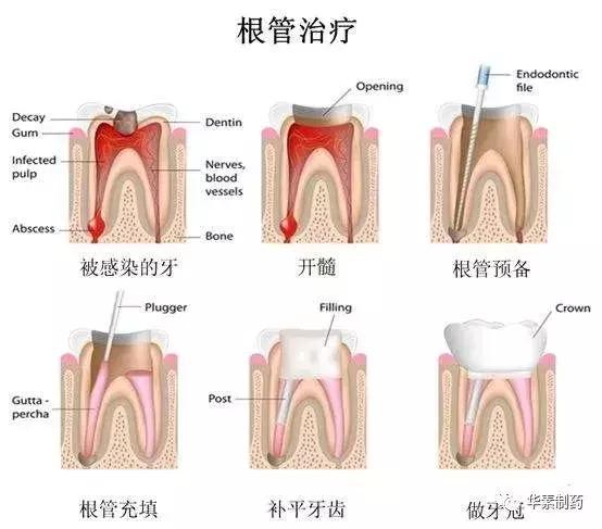 当牙齿出现小白点应该怎么办,当牙齿有黑线条