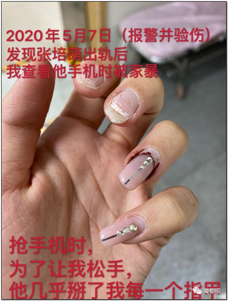 短跑名将张培萌家暴事件,短跑名将张培萌被控家暴