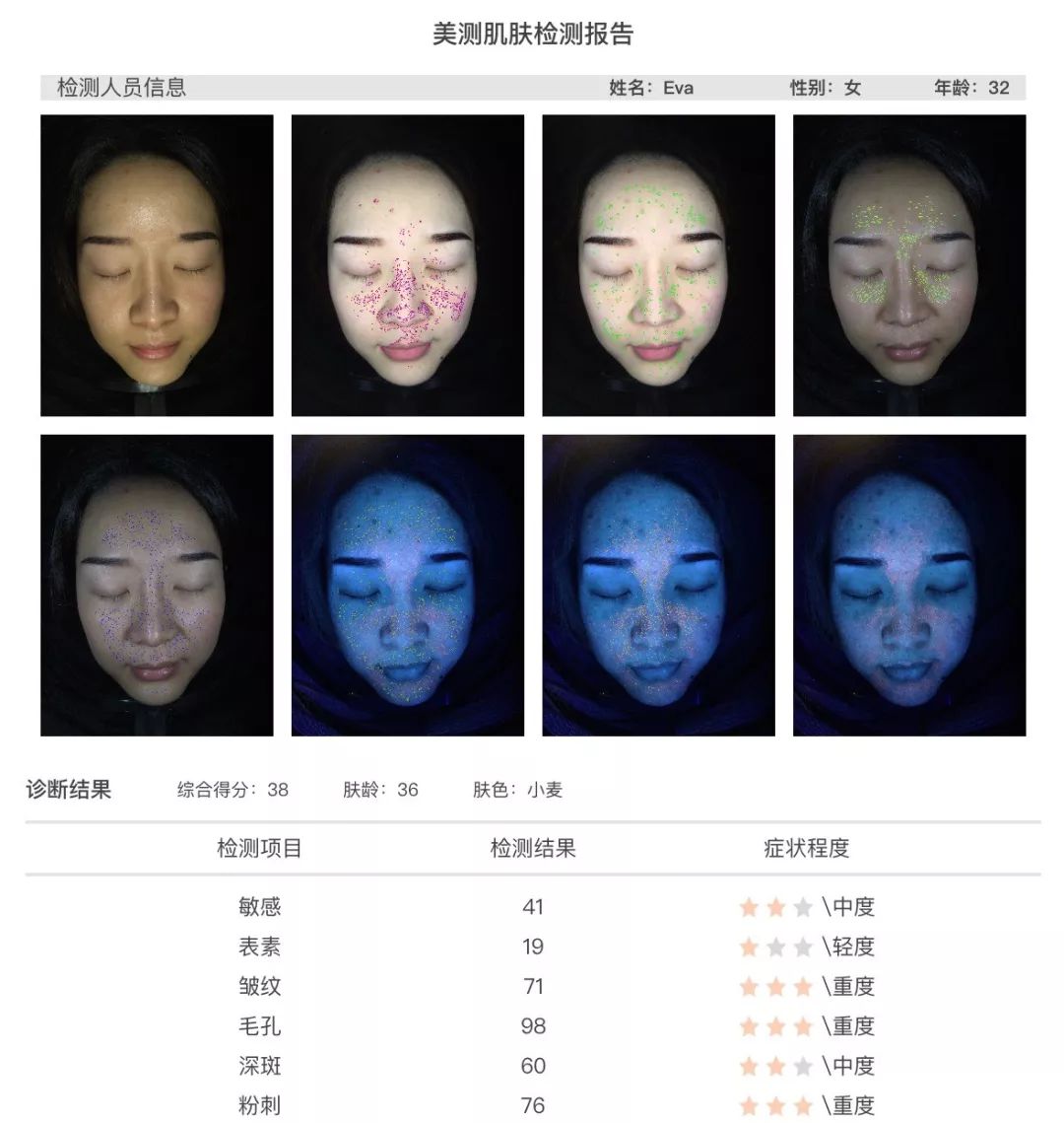 小茂肌诊室∣美容仪挑战：家用美容仪到底值得投资吗？