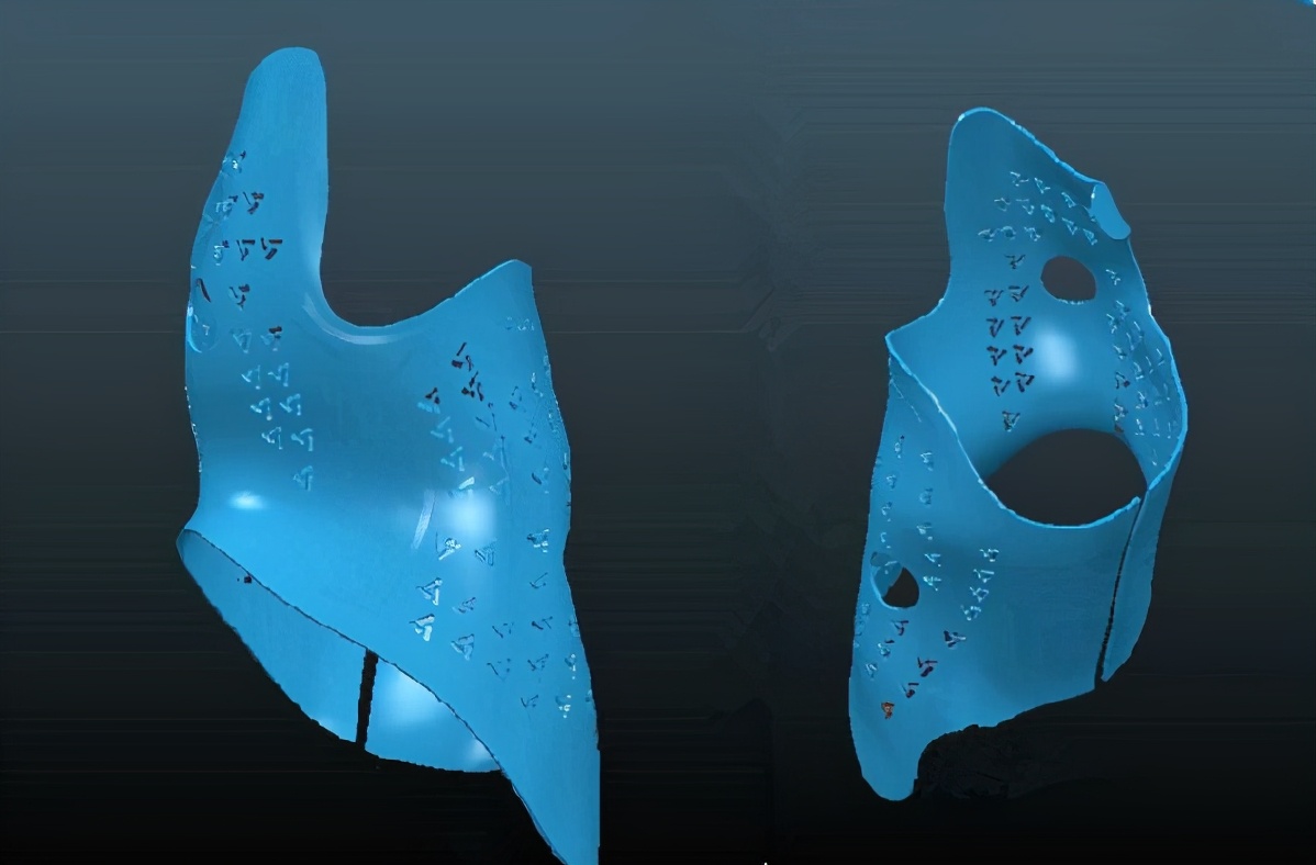 脊柱侧弯的矫正方法之支具治疗