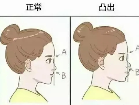 蔡徐坤整牙前图片,蔡徐坤整牙前后照片