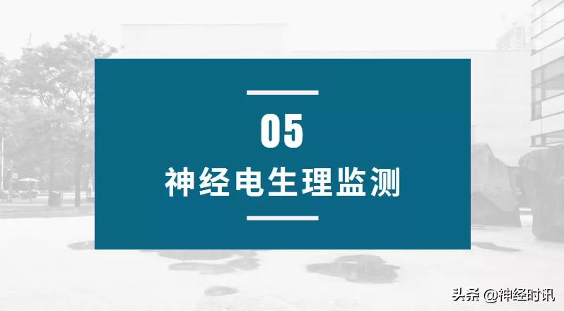 脑卒中病情监测指南,2018急性脑卒中指南ppt