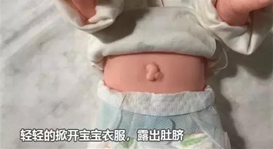 新生儿脐带一个月还没脱落正常吗,新生儿脐带一个月还没掉正常吗