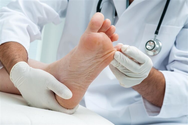 脚底长个鸡眼怎么治才除根,脚底长了鸡眼怎么去掉