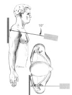 浏阳骨伤科医院髋关节脱位,肩锁关节脱位看骨伤科吗