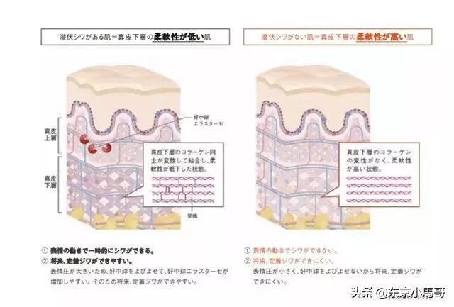 pola抗皱精华能减轻法令纹吗 (pola去皱精华限定套装)