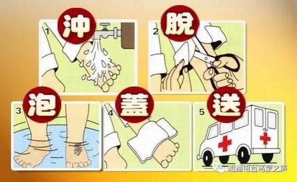 烧烫伤后有疤痕怎么办？《祝您健康》昭通市第二人民医院保刘俊医生支招