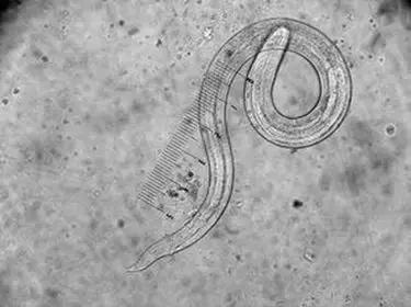 重口味科普，挠完“菊花”要不要洗手？