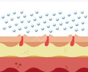 腿上有鱼鳞皮屑怎么办,腿上起皮屑就是鱼鳞病
