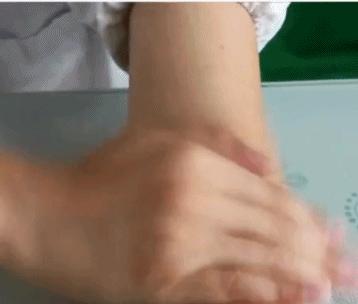 拍打肘窝出现紫痧治疗嗓子疼,小胳膊窝拍打出痧有哪些好处