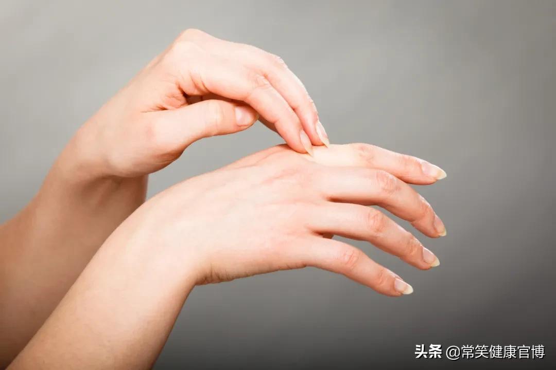 春夏交替皮肤过敏痒,季节性过敏全身痒是怎么回事