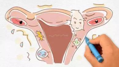 月经前白带增多是正常吗,月经期前白带增多正常吗