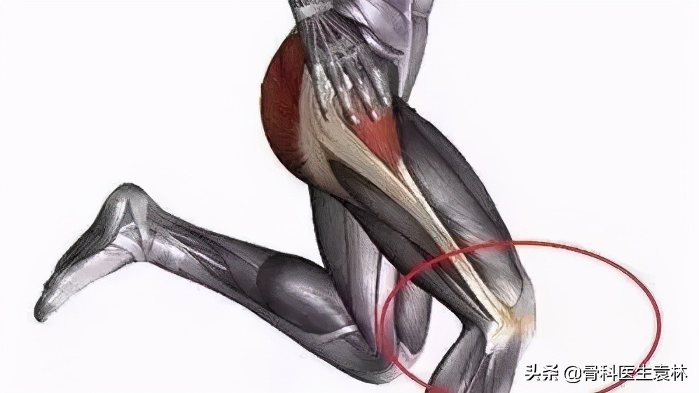 跑完步后膝盖疼是什么原因,跑完步膝盖不舒服怎么缓解