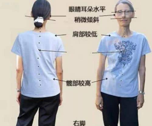 毁气质的高低肩,2招变成天生“衣架子”,练它