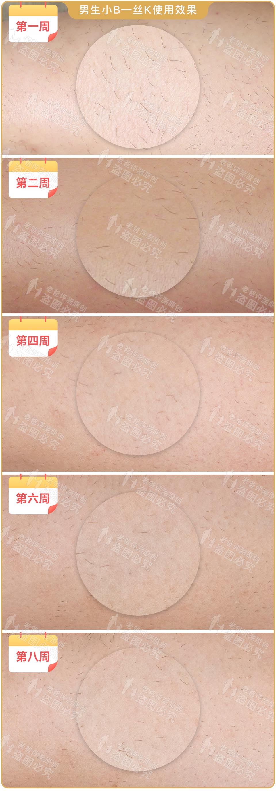 最真实的脱毛仪,bequeen脱毛仪实测