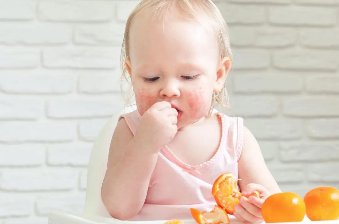 宝宝霜能治疗湿疹吗,宝宝用弱效激素治疗湿疹