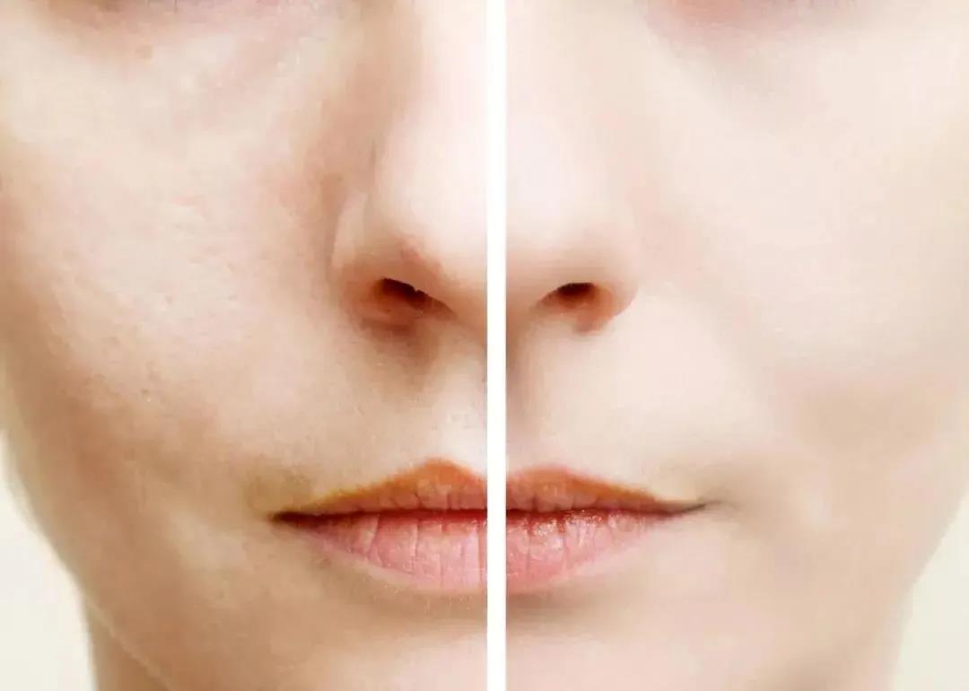 空调房皮肤干燥痒怎么快速解决,屋里干燥皮肤痒