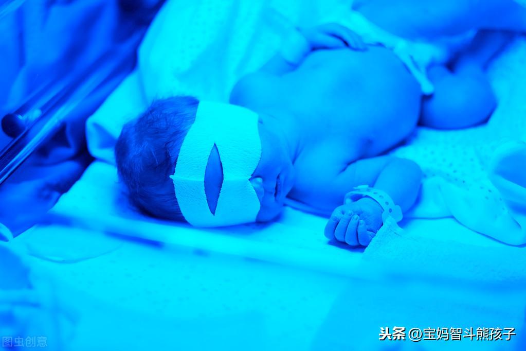 奶奶给宝宝晒黄疸的视频,在家给孩子黄疸照蓝光