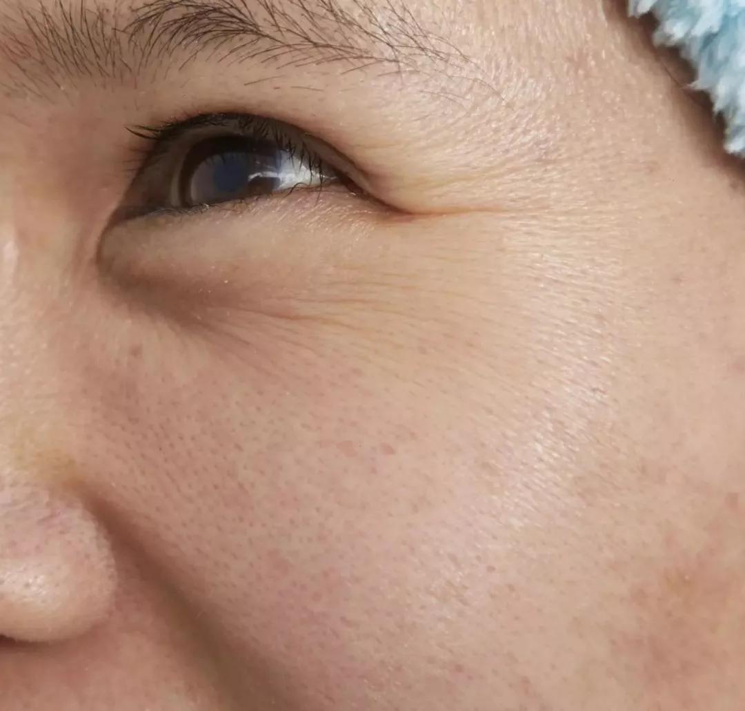 真人改造|不靠医美，一天实现“换皮”