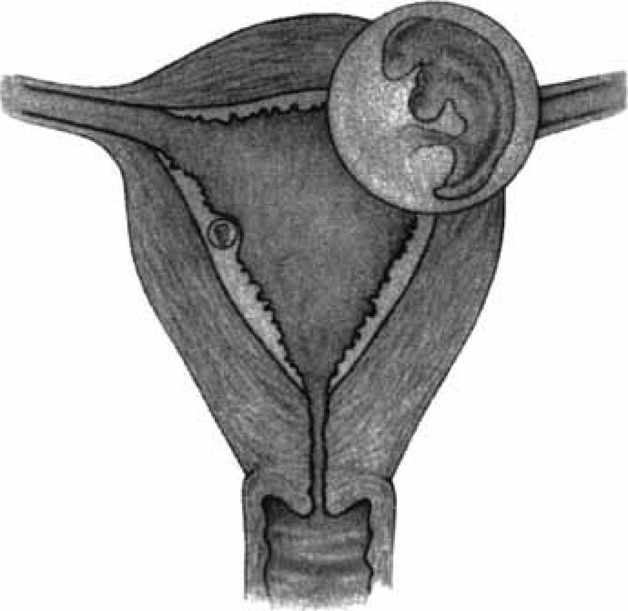 怀孕第1周胚胎发育状况,怀孕1-10个月胎儿发育图