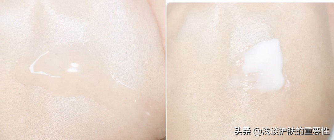 40岁干皮有斑用什么护肤品好,40岁皮肤干燥有斑点
