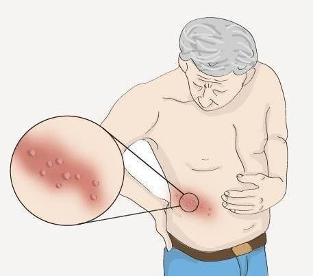 胸痛不一定是心脏的问题,胸痛不一定是冠心病