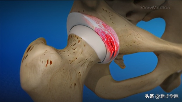 稍微运动浑身咔咔响,为什么运动的时候身体咔咔的响