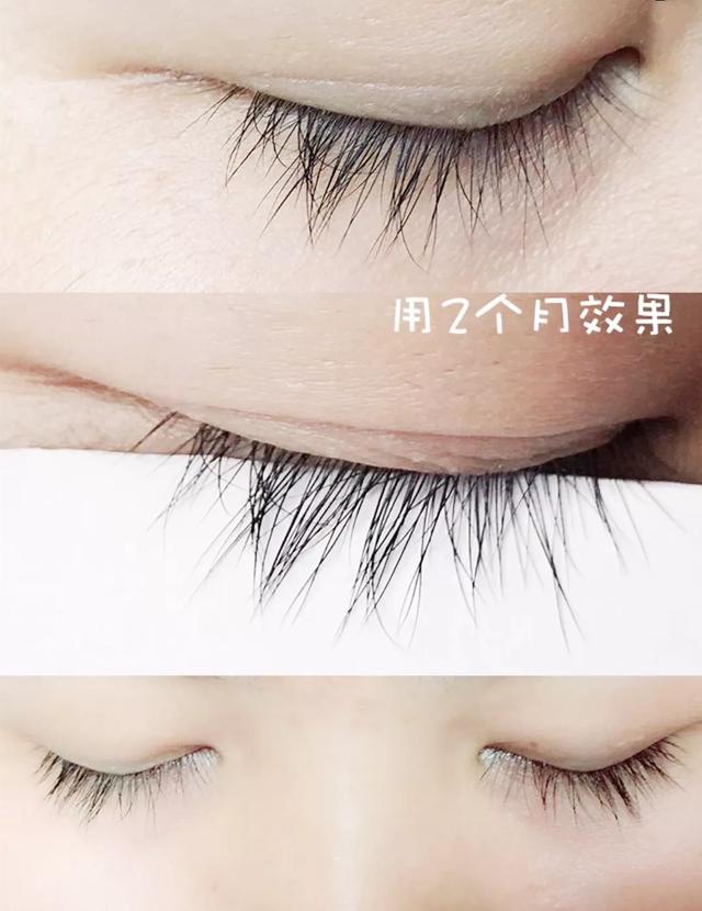 真实好用的睫毛增长液,日本睫毛增长液