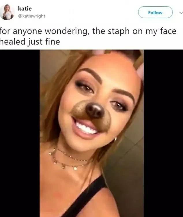 大惊失色!挤完痘痘这样做，很有可能会导致失明，甚至踏上黄泉路