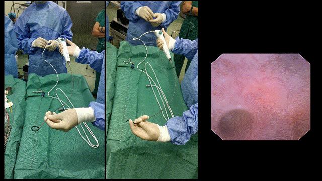 输尿管电子软镜,江苏一次性输尿管软镜