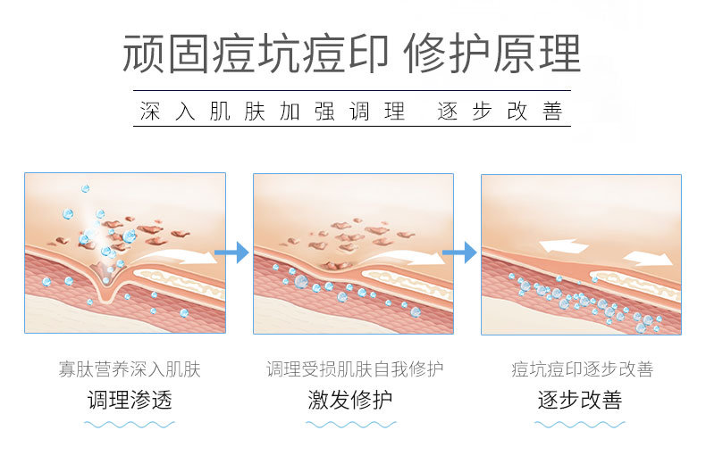 怎么拯救毛孔粗大堵塞,如何拯救已经粗大的毛孔