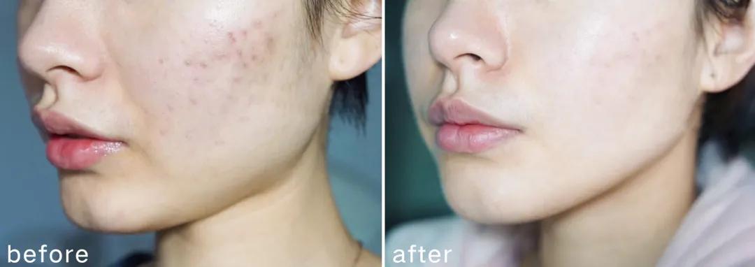 老国货祛痘真的有用吗,从明朝开始的国货