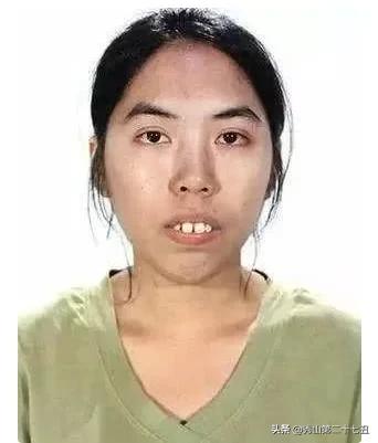 龅牙妹因为丑生活处处受挫，下定决心整容后，人生发生大翻转