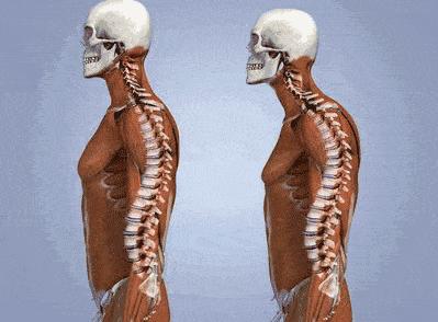 如何知道是真翘臀还是假翘臀,真翘臀和假翘臀是怎么判断的