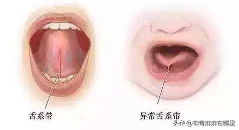 宝宝的舌头有点红怎么回事,宝宝的舌头有红点