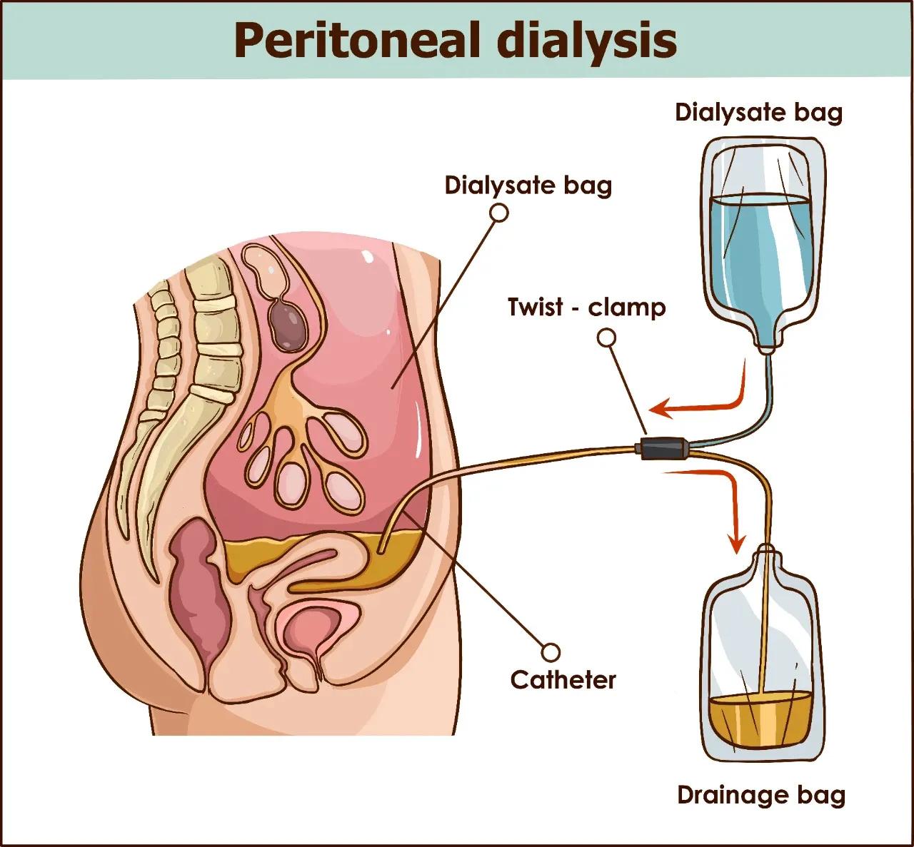 t波改变会导致双下肢浮肿吗,老人双下肢浮肿什么原因
