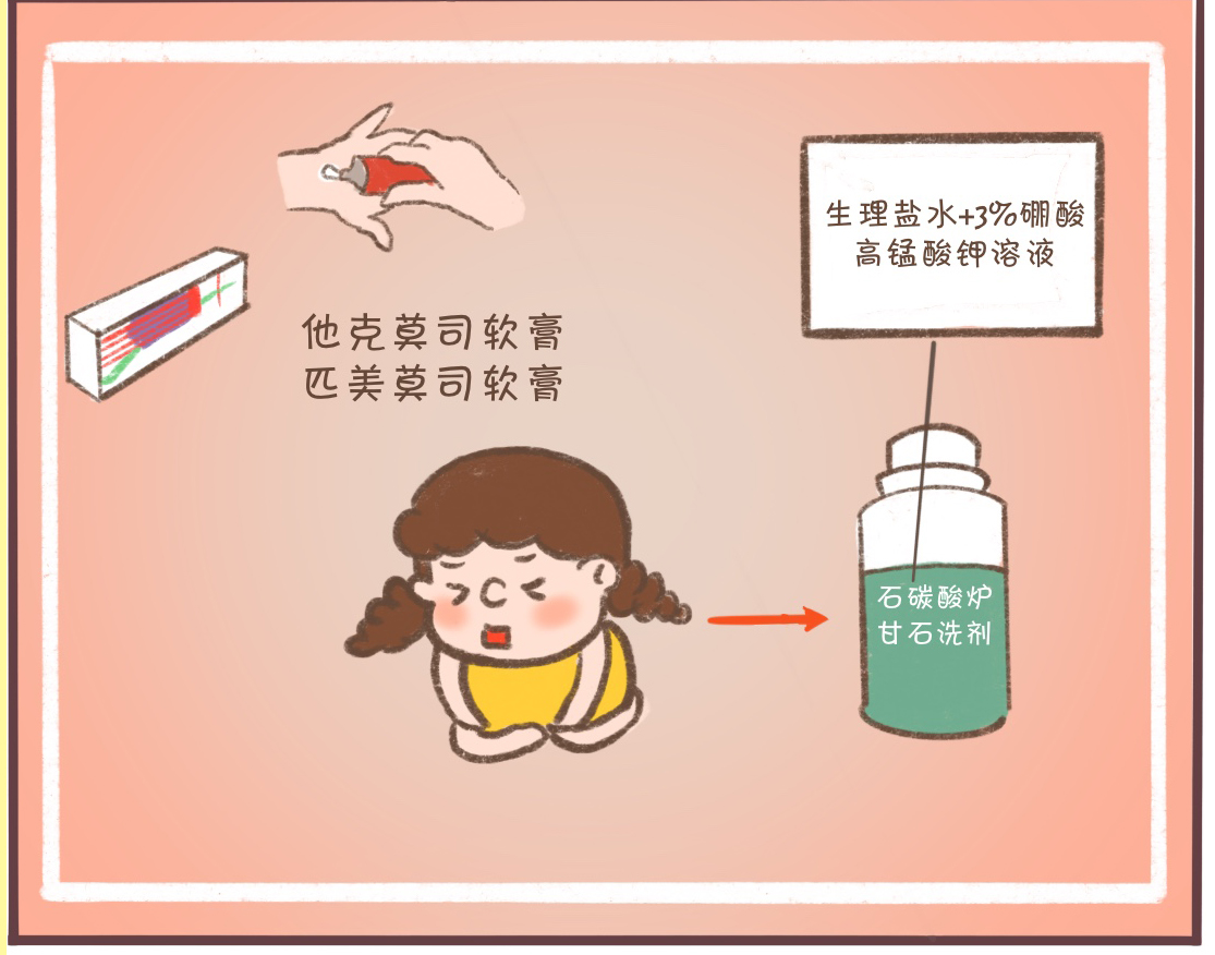 糖尿病湿疹瘙痒反复发作怎么办,湿疹瘙痒反复发作怎么办