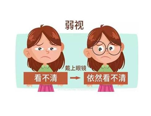 近视弱视训练加盟,视力矫正加盟店市场前景