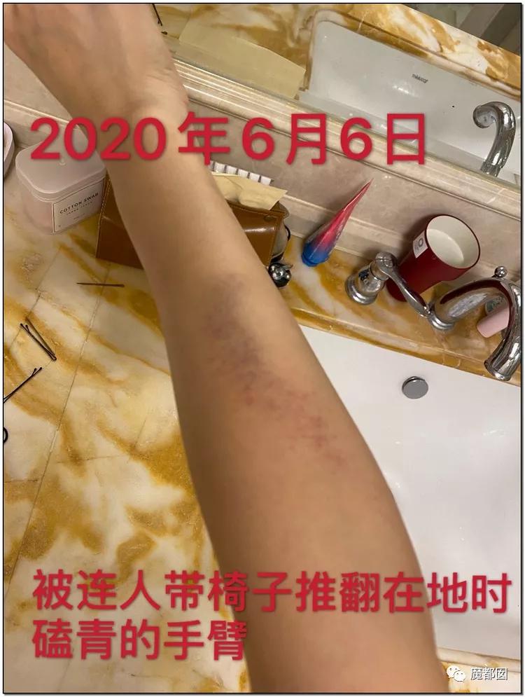 短跑名将张培萌被曝家暴,短跑名将张培萌殴打岳母被行拘