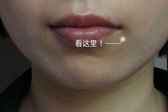嘴唇干裂起皮怎么护理秒变嘟嘟唇,嘴唇干燥唇纹深你应该这么做